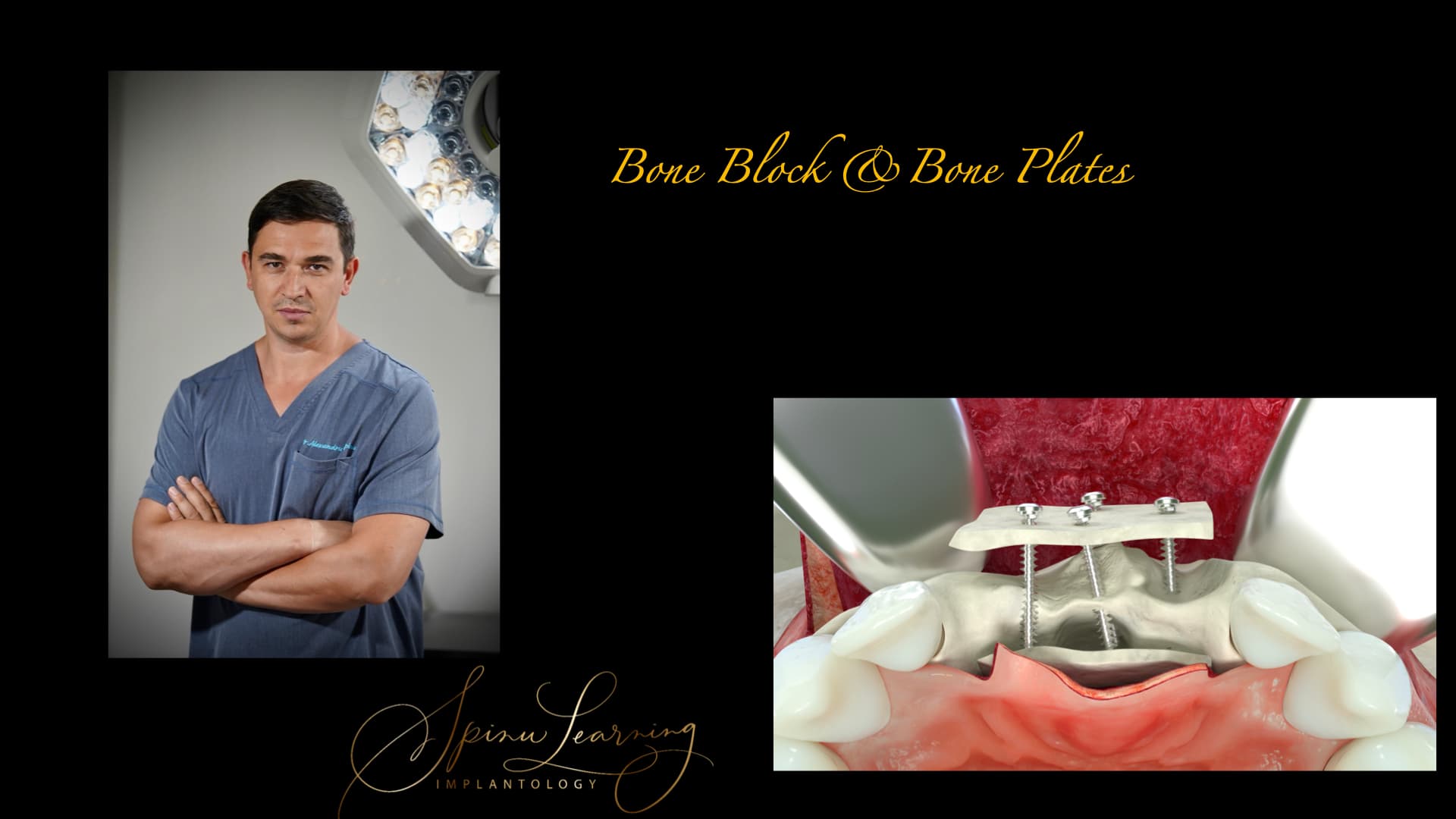 Blocuri Osoase și Plăcute Autogene